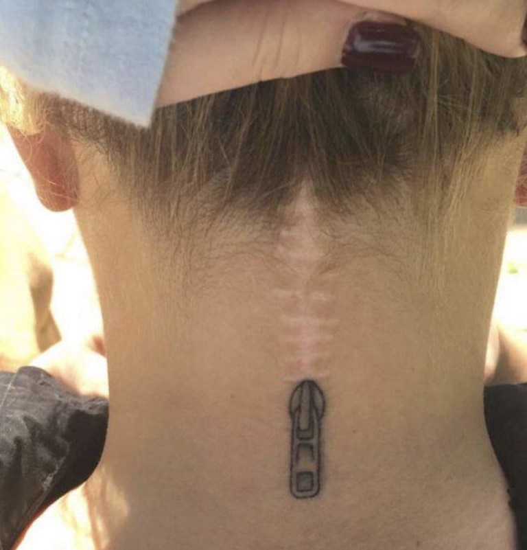 Tatuagens feitas para esconder cicatrizes #7