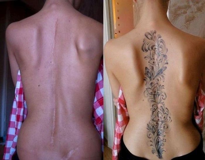 Tatuagens feitas para esconder cicatrizes #10