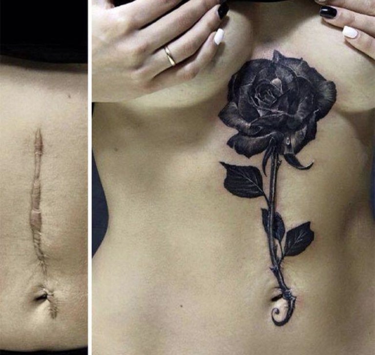 Tatuagens feitas para esconder cicatrizes #11